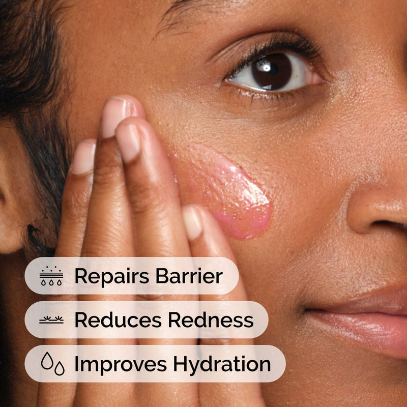 The Ordinary - Soothing & Barrier Support Serum |